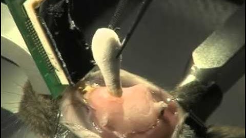 High-density EEG Recordings of the Freely Moving Mice u