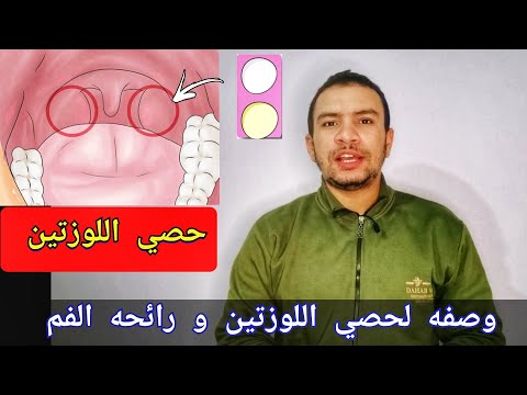 فيديو: كيفية تنظيف خبايا اللوزتين؟