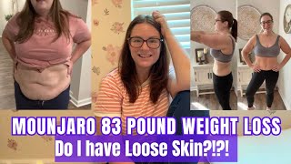 -83 POUNDS ON MOUNJARO | DO I HAVE LOOSE SKIN?!