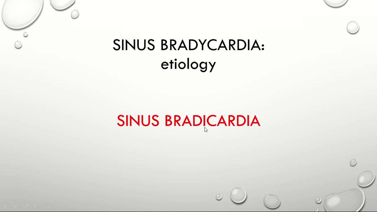 Sinus bradycardia causes Mnemonic YouTube