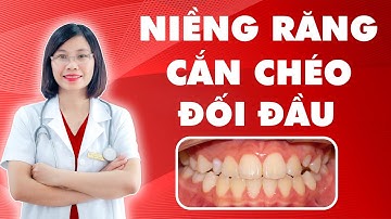 Cùng Chuyên Gia Tư Vấn Niềng Răng Cắn Chéo, Đối Đầu | Bác sĩ Thu Gia Lâm