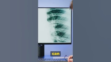 The Most Toxic Element : Beryllium #beryllium #element #periodictable #chemistry #science #toxic