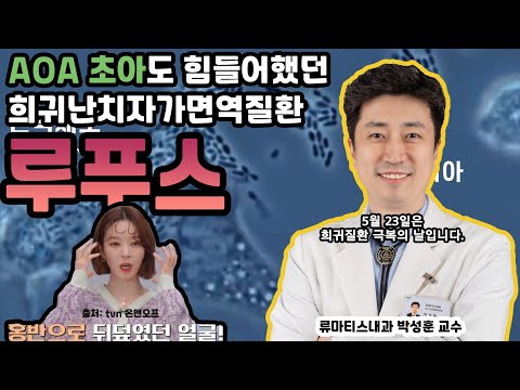 AOA초아도 앓았던 질환 &rsquo;전신홍반루푸스&rsquo; 에 대해서(feat. 류마티스내과 박성훈 교수)[대구가톨릭대병원]