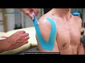 Kinesiotape para el dolor de hombro | Dermaplast Active