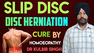 Disc Herniation,Slip Disc Best Homeopathic Medicines ||| Dr Kulbir Singh.