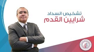 تشخيص انسداد شرايين القدم | دكتور وليد الدالي