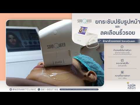 SONO QUEEN EP.1/ยกกระชับปรับรูปหน้า ไม่ต้องผ่าตัด @หมอปุ๊ Neramit Clinic
