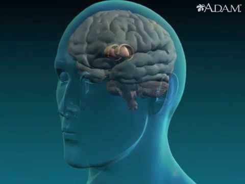 what is the cause of athetosis animation basal ganglia injury