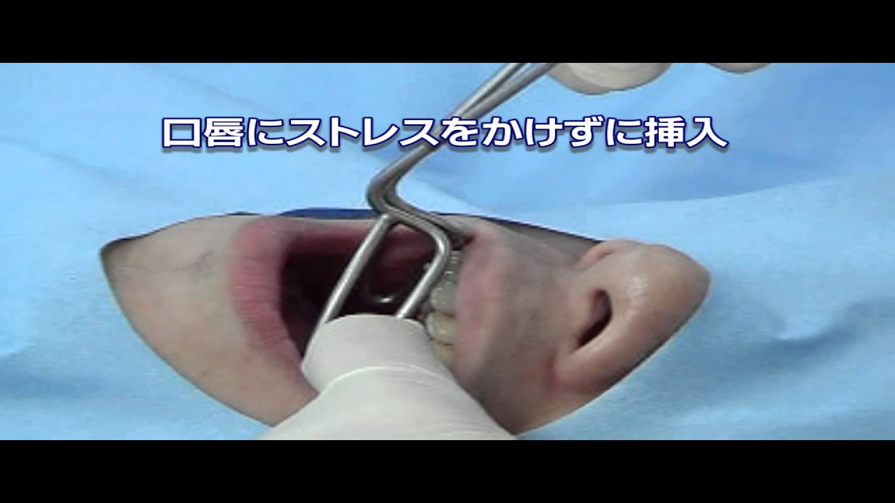 リップリトラクター 175×85×35mm｜株式会社インプラテックスの取扱い商品