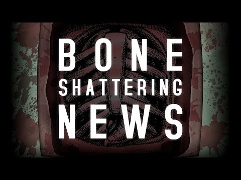 Surgeon Simulator: BONE-SHATTERING NEWS