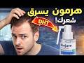 هرمون يسرق شعرك فينجوفي سبراي Finjuve Spray