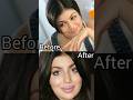 Ayesha Takia Plastic Surgery Ruined Her Face Shorts Ayeshatakia Plasticsurgery 