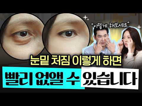 집에서 여기 눌러보세요! 눈밑 처짐 '이 방법'으로 10분 만에 해결됩니다🔥- 권수현 김종식 피부과 전문의