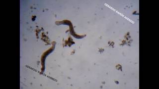 Microfauna En Sphagnum