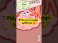 🔥 PCOS Explained | Causes, Symptoms, Treatment 💊🌸 # shorts #animation #funny#viral