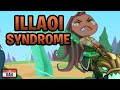 Illaoi Syndrome