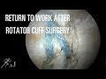 When can you return to work after rotator cuff surgery?