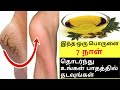 Patha vedippu tips in tamil / cracked heels remedy / how to treat cracked heels