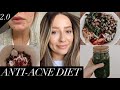 Anti-acne diet | Foods that cleared my skin!