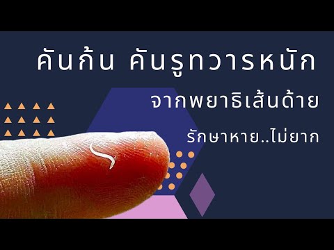 คันก้น คันรูทวารหนัก จากพยาธิเส้นด้าย รักษาหาย ไม่ยาก| หมอยาพาคุย