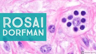 Extranodal Rosai-Dorfman Disease 101...Explained by a Pathologist