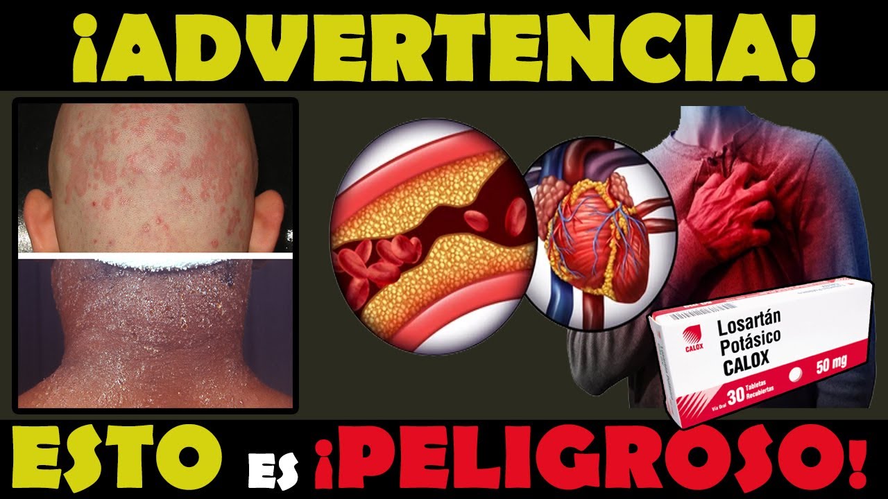 5 Efectos Más RAROS y PELIGROSOS del LOSARTAN Efectos Secundarios