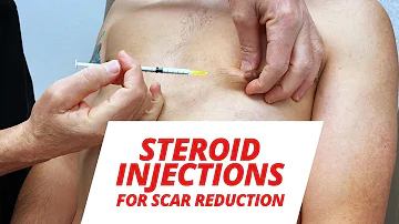Steroid Injections After Gynecomastia Surgery (SCAR TISSUE REDUCTION)