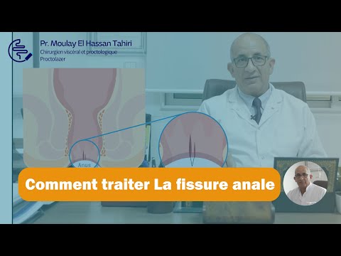 Pr Moulay EL Hassan Tahiri La Fissure Anale Et Comment Peut On La Traiter 