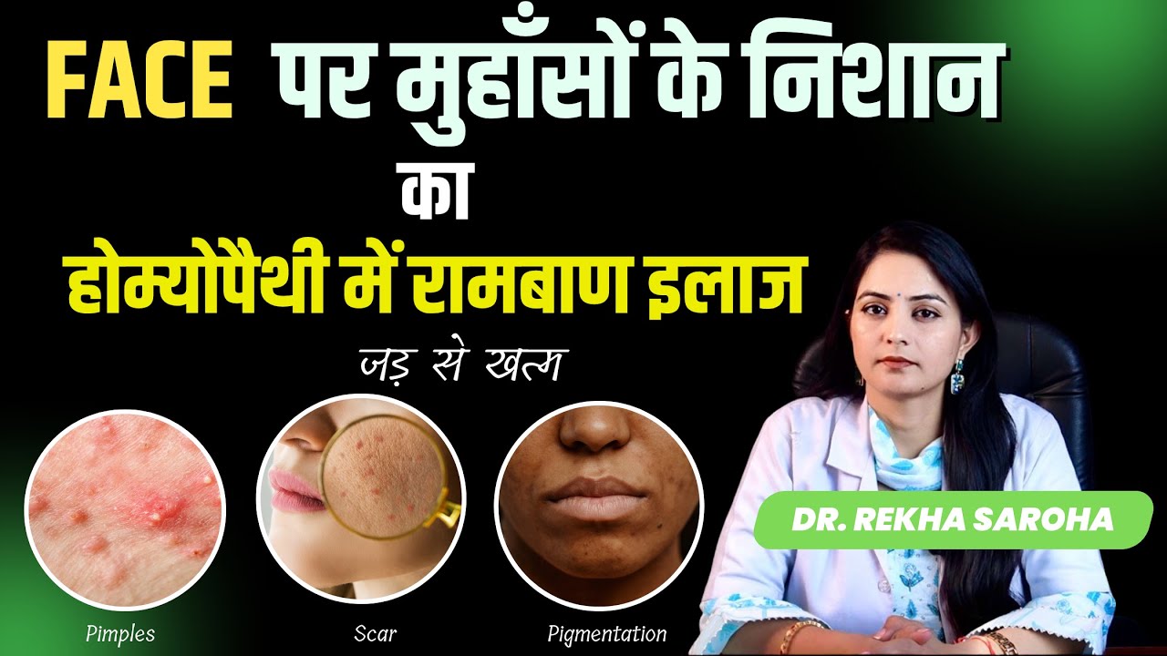 Homeopathy for Acne & Scars | Get Glowing, Scar-Free Skin Naturally | Dr. Rekha Saroha