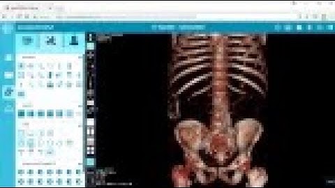 Viewing in 3D - postDICOM Free DICOM Viewer