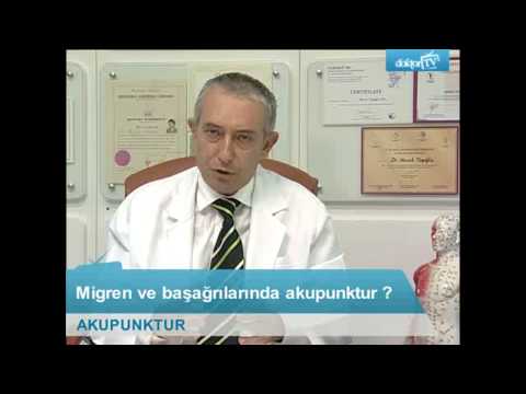 Migren Ve Baş Ağrılarında Akupunktur Uygulamaları Nasıl Yapılır?