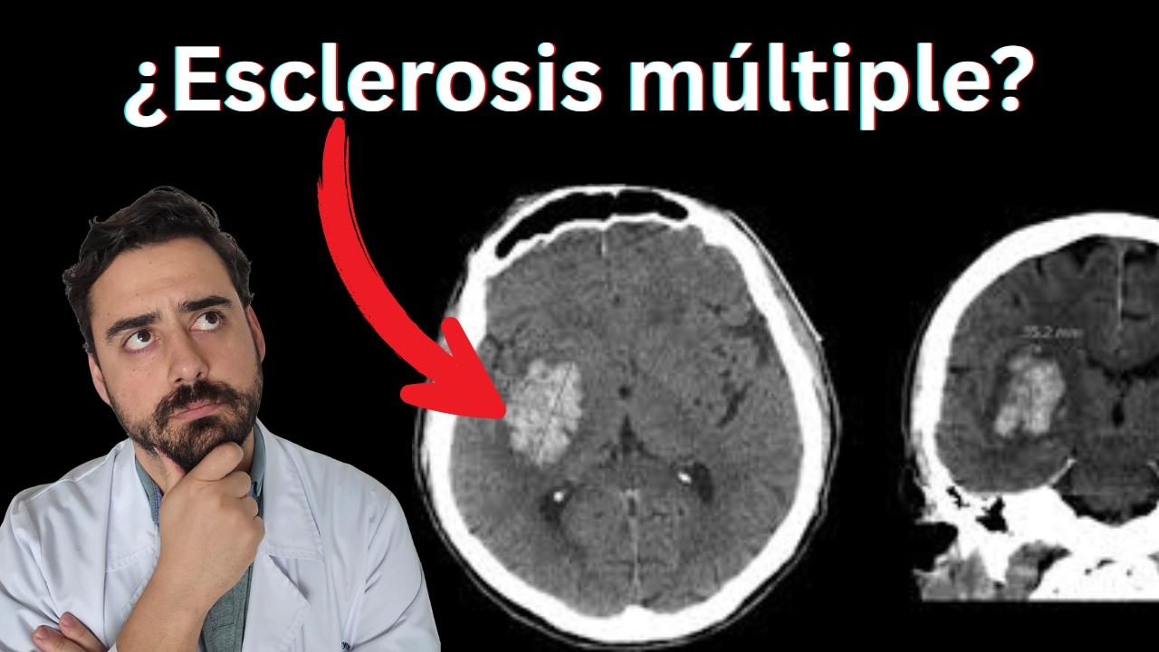¿Qué enfermedades detecta la resonancia magnética?