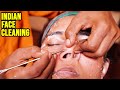 INDIAN FACE CLEANING 🟡 NOSE BLACKHEAD EXTRACTED by MASTER CRACKER 🟡 ASMR sleep