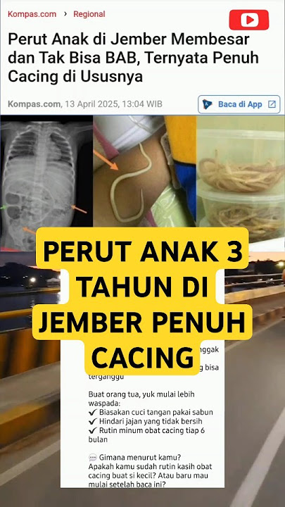 Cacing Bersarang diperut Anak 3 tahun #trending #trend #beritaviral #kesehatan #jatim