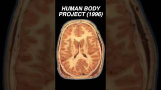 "Visible Woman" | Human Body Project completed (1996) #Anatomy #Radiology #Science #Medical #Human