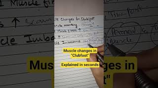 Muscle Change In Club Foot #pediatricphysicaltherapy #lecture7