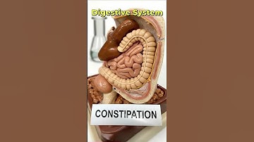 3D Animation of Constipation Explained | Gut Health
