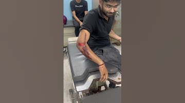 Accident karwa liya 😭😭 | #minivlog #ashortaday #tranding #shorts