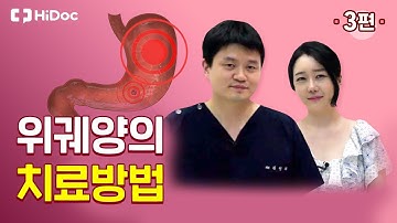 위궤양의 치료 방법