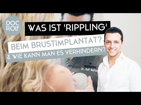 Was ist RIPPLING beim BRUSTIMPLANTAT?! Dr. Rolf Bartsch erklärt...