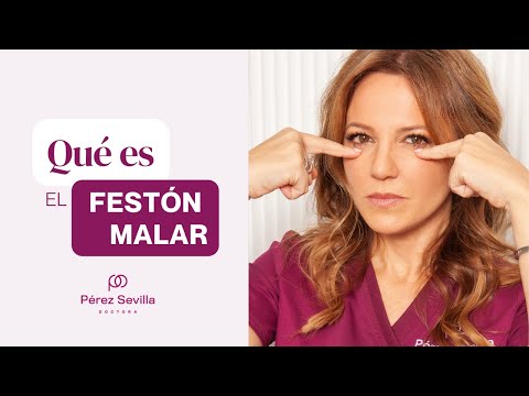 Video: ¿Por qué significa festón?