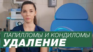 Папилломы и кондиломы / Удаление папиллом / Нужно ли удалять кондиломы