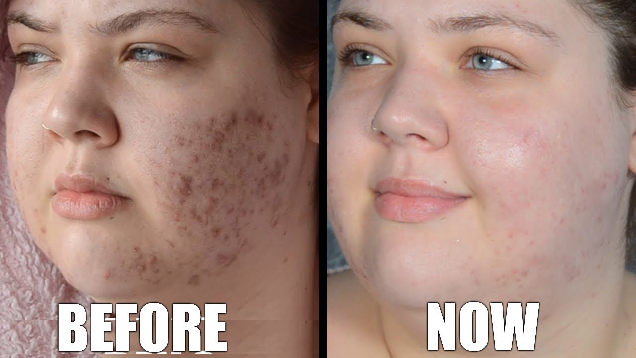 revolution spf 30 protecting boost