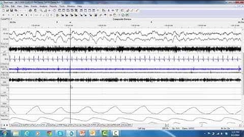 21. RemLogic Association Settings