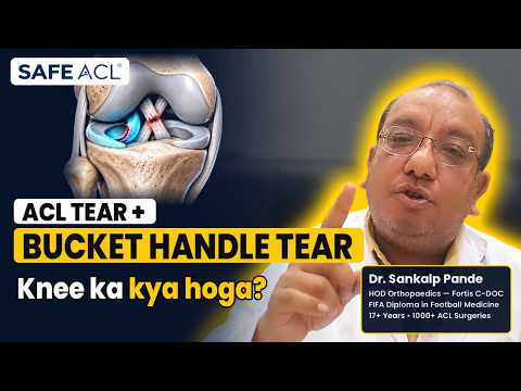 ACL tear with bucket handle meniscus tear: what happens now?