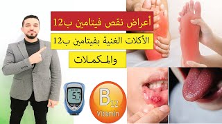 أعراض نقص فيتامين ب 12 | الأكلات الغنية بفيتامين ب 12 والمكملات