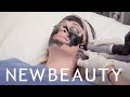 The Carbon Laser Peel IS the Secret to Better Skin in 20 Minutes | NewBeauty