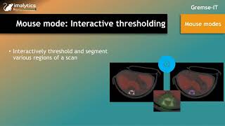Mouse mode: "Interactive thresholding"