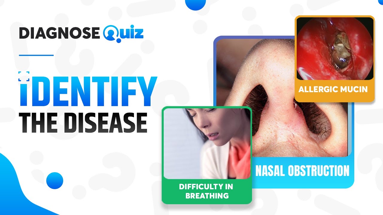 Can you Identify this Disease? | Diagnosequiz #11