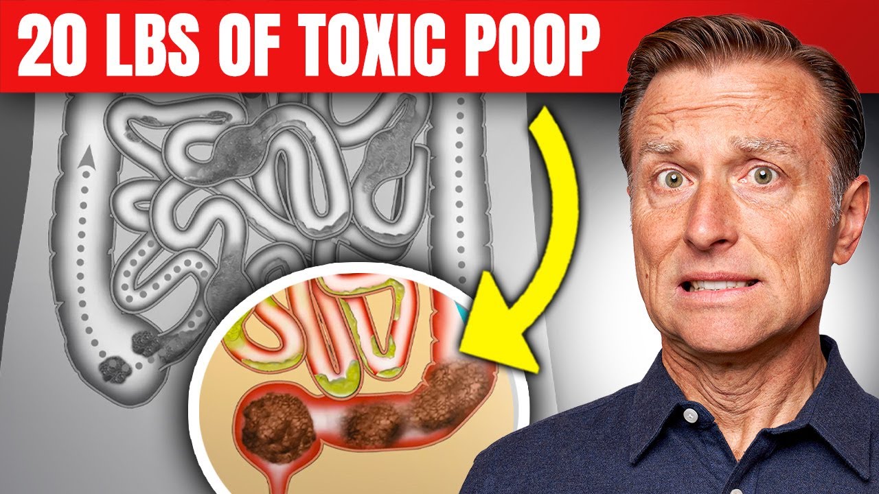 ⁣Do We REALLY Have 5 to 20 lbs of Toxic Poop in Our Colons?